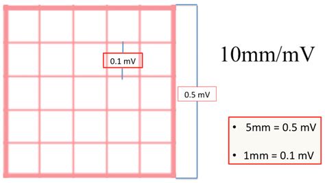 How Many Small Squares Are in a Large Square on ECG Tracing Paper? And Why Do They Remind Me of a Chessboard?